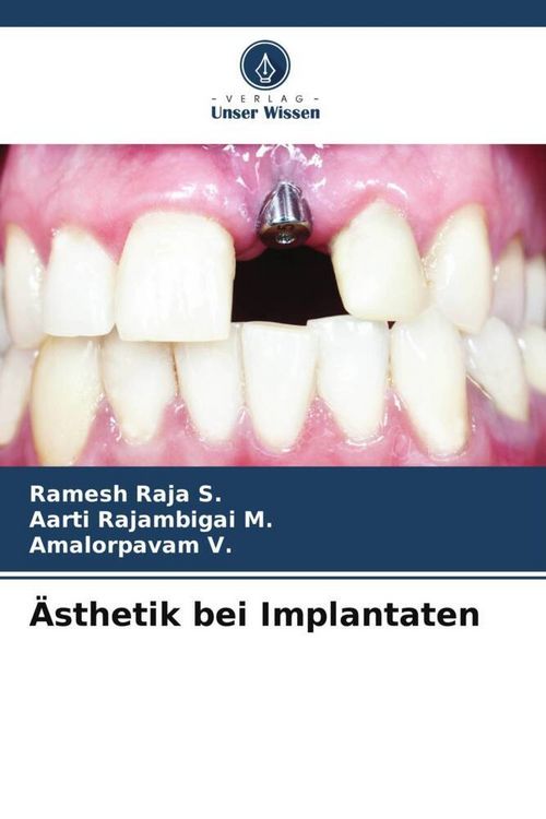 Produktbild: &Auml;sthetik bei Implantaten
