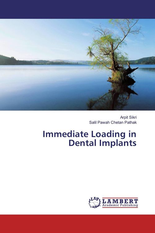 Produktbild: Immediate Loading in Dental Implants
