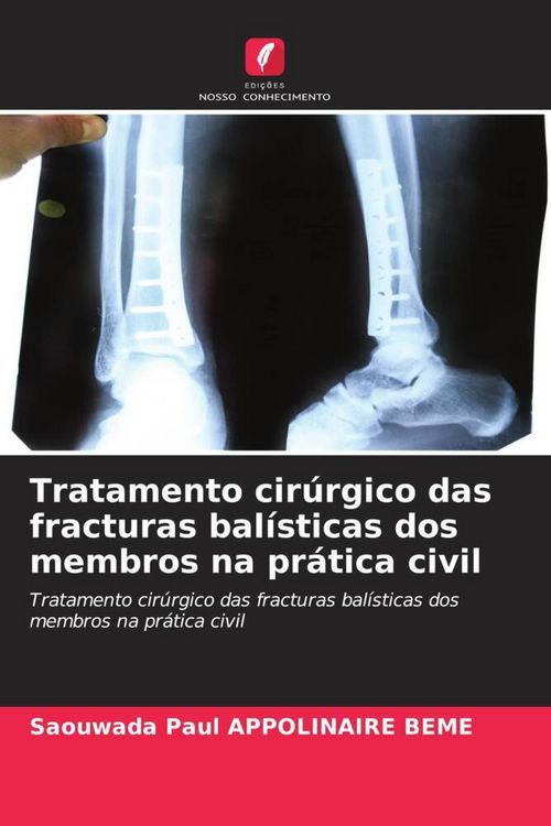 Produktbild: Tratamento cir&uacute;rgico das fracturas bal&iacute;sticas dos membros na pr&aacute;tica civil