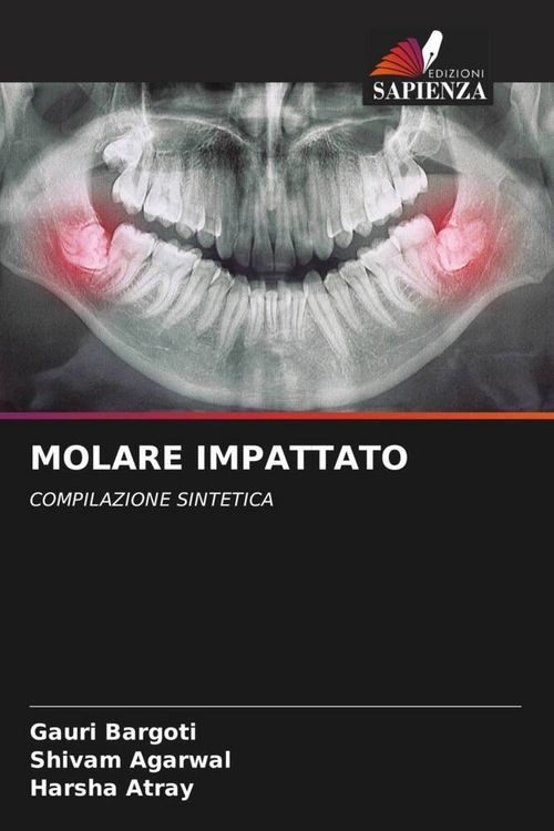 Produktbild: Molare Impattato