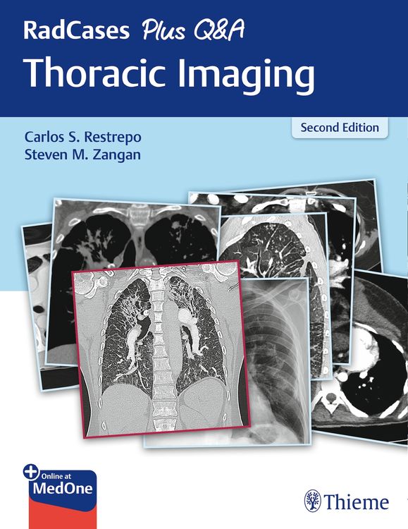Produktbild: RadCases Plus Q&A Thoracic Imaging