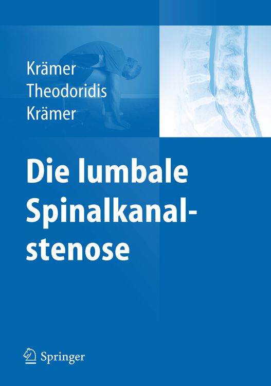Produktbild: Die lumbale Spinalkanalstenose