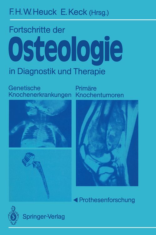 Produktbild: Fortschritte der Osteologie in Diagnostik und Therapie