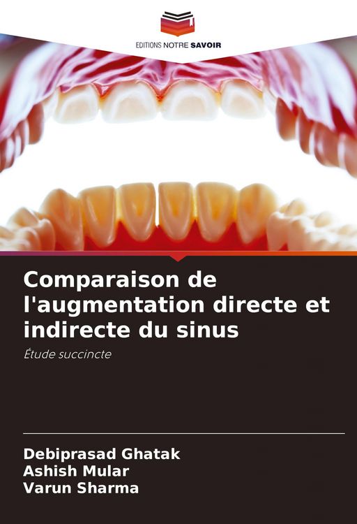 Produktbild: Comparaison de l'augmentation directe et indirecte du sinus