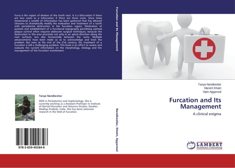 Produktbild: Furcation and Its Management