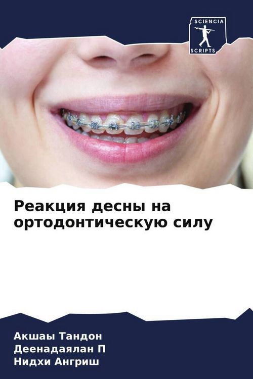 Produktbild: Reakciq desny na ortodontichesku&uuml; silu
