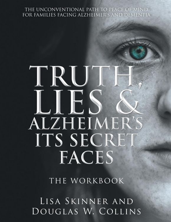 Produktbild: Truth, Lies & Alzheimer's Its Secret Faces