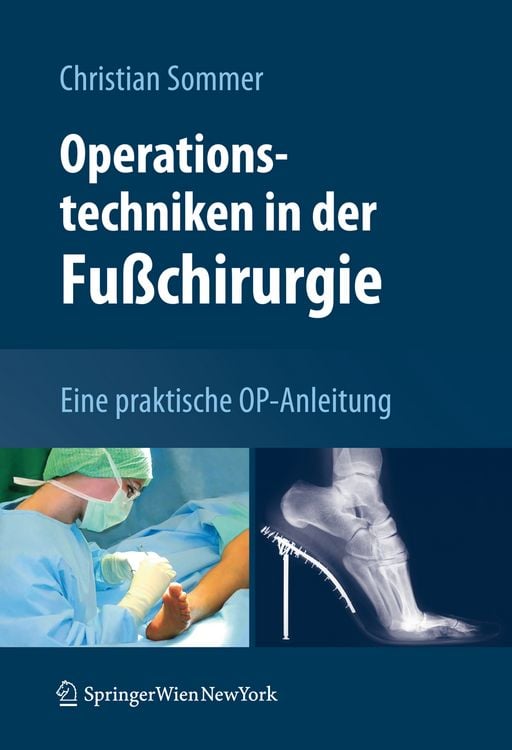 Produktbild: Operationstechniken in der Fu&szlig;chirurgie