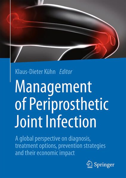 Produktbild: Management of Periprosthetic Joint Infection