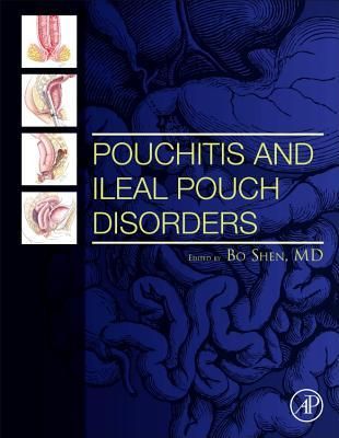 Produktbild: Pouchitis and Ileal Pouch Disorders
