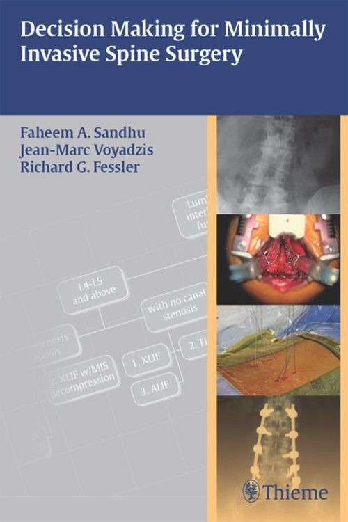 Produktbild: Decision Making for Minimally Invasive Spine Surgery