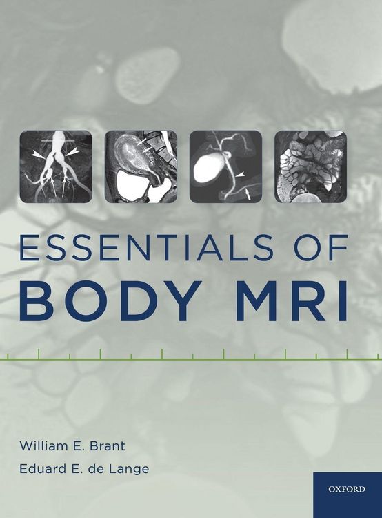 Produktbild: Essentials of Body MRI