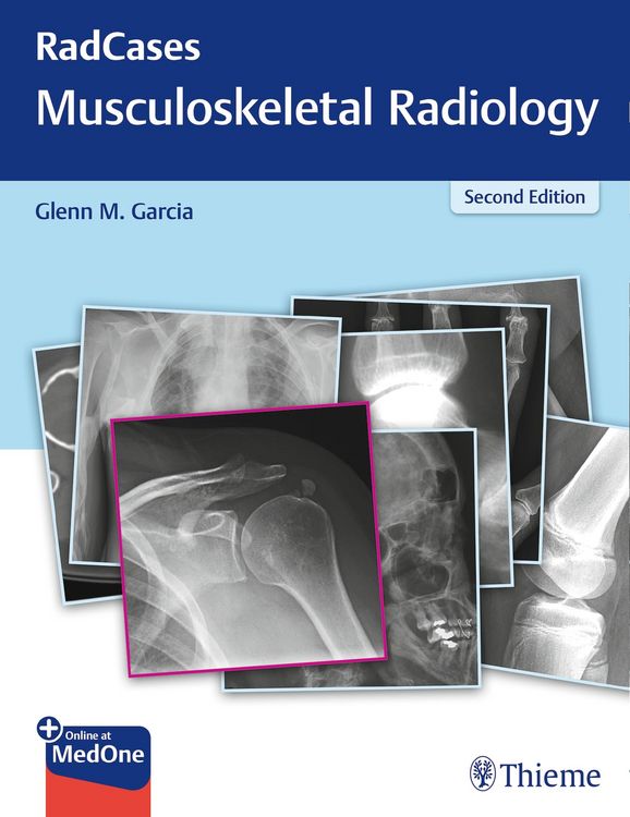 Produktbild: RadCases Q&A Musculoskeletal Radiology