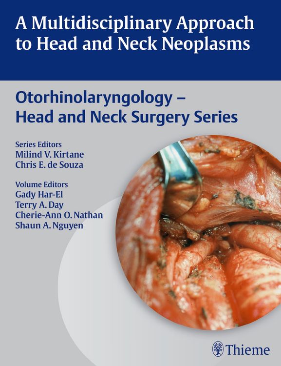 Produktbild: A Multidisciplinary Approach to Head and Neck Neoplasms