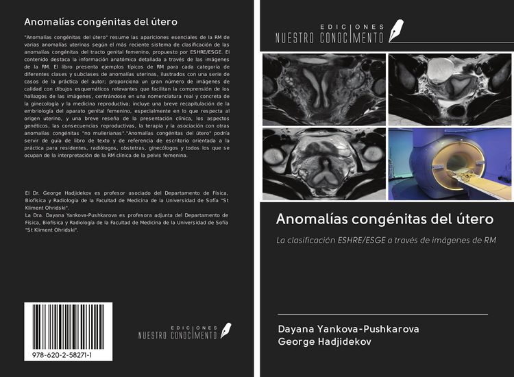 Produktbild: Anomal&iacute;as cong&eacute;nitas del &uacute;tero