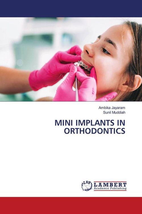 Produktbild: Mini Implants in Orthodontics