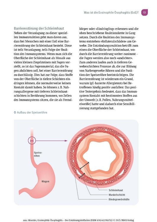 Produktbild: Eosinophile &Ouml;sophagitis - Der Ern&auml;hrungsleitfaden