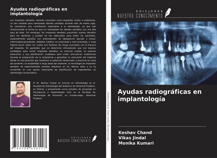 Produktbild: Ayudas radiogr&aacute;ficas en implantolog&iacute;a