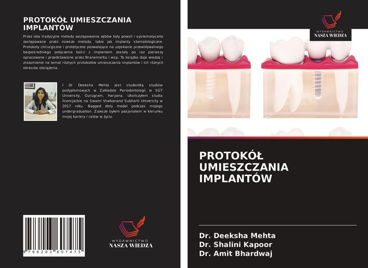 Produktbild: Protok&oacute;&iquest; Umieszczania Implant&oacute;w