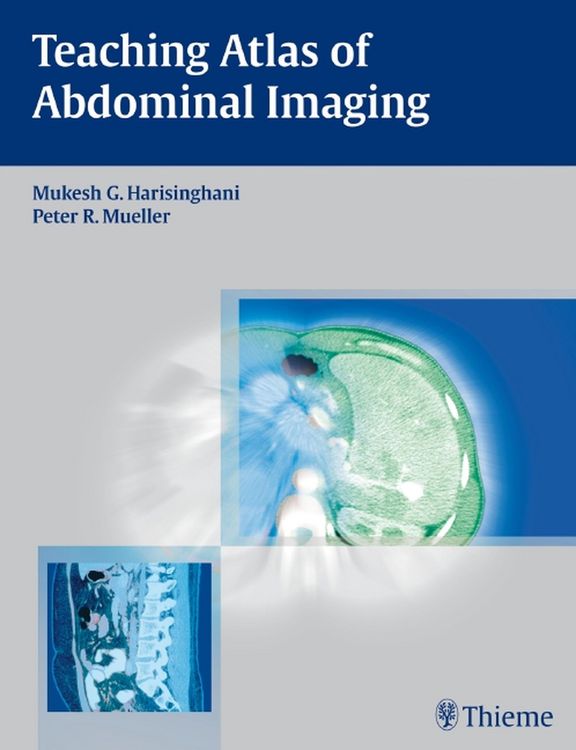 Produktbild: Teaching Atlas of Abdominal Imaging