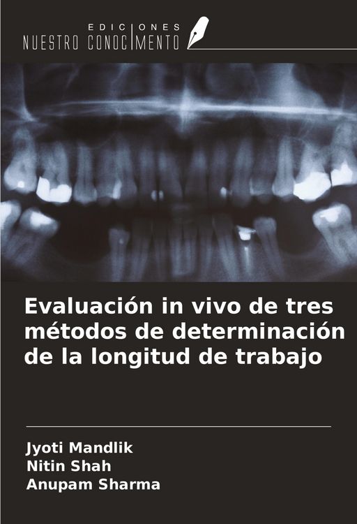 Produktbild: Evaluaci&oacute;n in vivo de tres m&eacute;todos de determinaci&oacute;n de la longitud de trabajo
