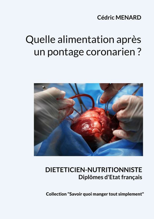 Produktbild: Quelle alimentation apr&egrave;s un pontage coronarien ?
