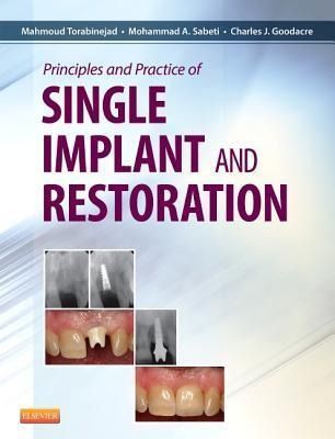 Produktbild: Principles and Practice of Single Implant and Restoration