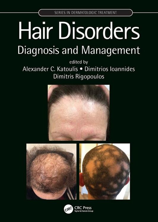 Produktbild: Hair Disorders