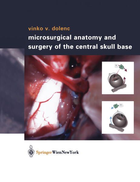 Produktbild: Microsurgical Anatomy and Surgery of the Central Skull Base