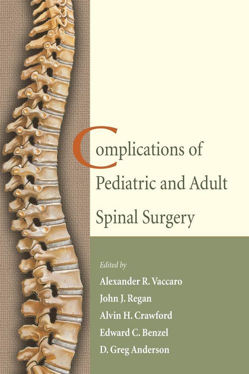 Produktbild: Complications of Pediatric and Adult Spinal Surgery