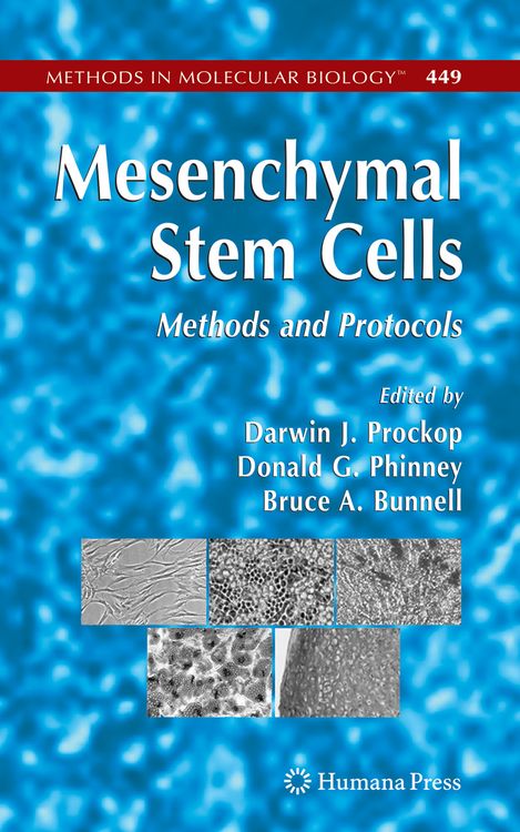 Produktbild: Mesenchymal Stem Cells