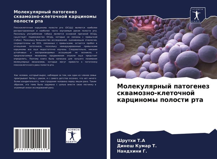 Produktbild: Molekulqrnyj patogenez skwamozno-kletochnoj karcinomy polosti rta