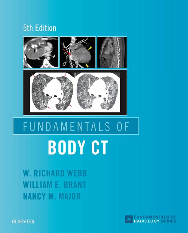 Produktbild: Fundamentals of Body CT E-Book