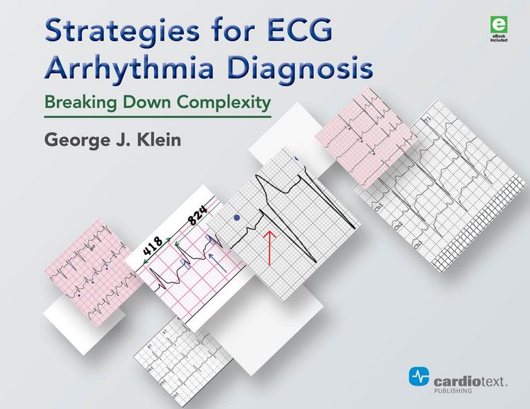 Produktbild: Strategies for ECG Arrhythmia Diagnosis