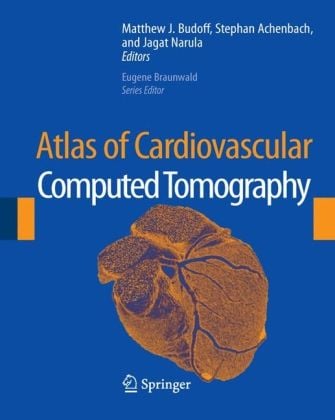 Produktbild: Atlas of Cardiovascular Computed Tomography