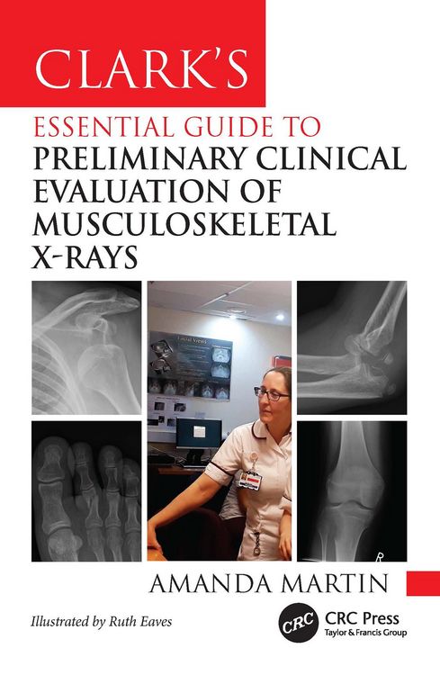 Produktbild: Clark's Essential Guide to Preliminary Clinical Evaluation of Musculoskeletal X-rays