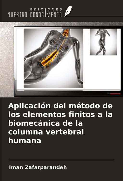 Produktbild: Aplicaci&oacute;n del m&eacute;todo de los elementos finitos a la biomec&aacute;nica de la columna vertebral humana