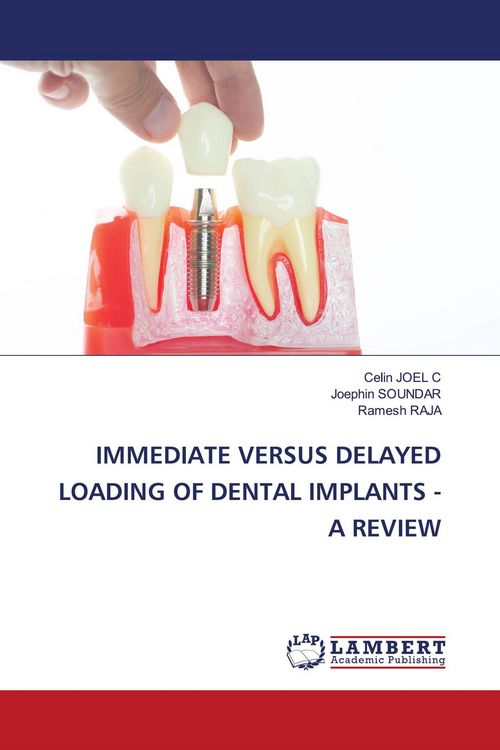 Produktbild: Immediate Versus Delayed Loading Of Dental Implants - a Review