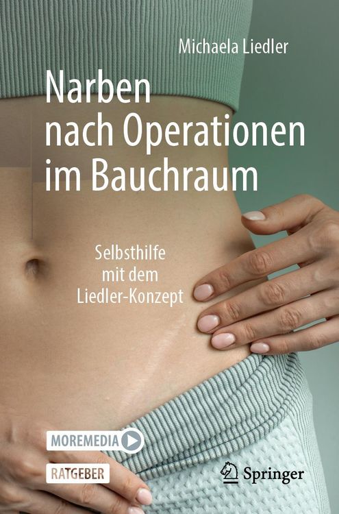Produktbild: Narben nach Operationen im Bauchraum