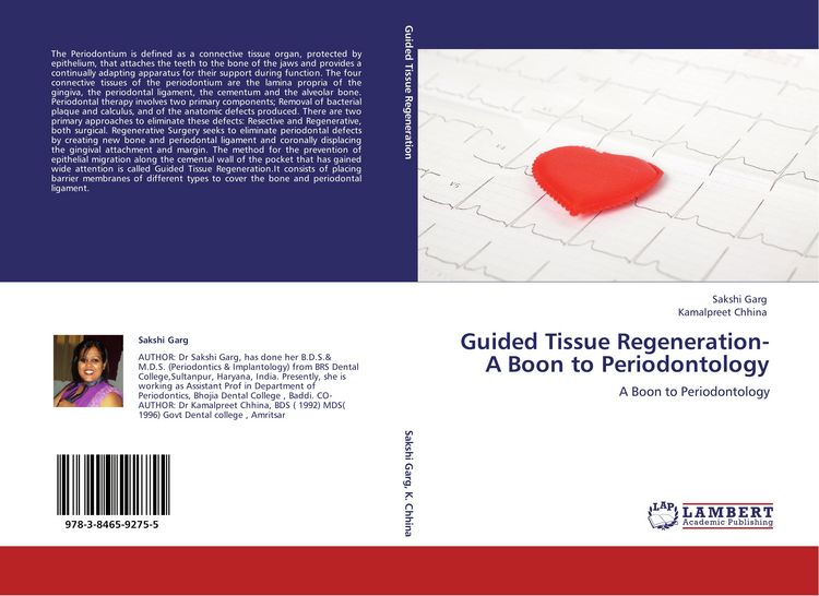 Produktbild: Guided Tissue Regeneration- A Boon to Periodontology