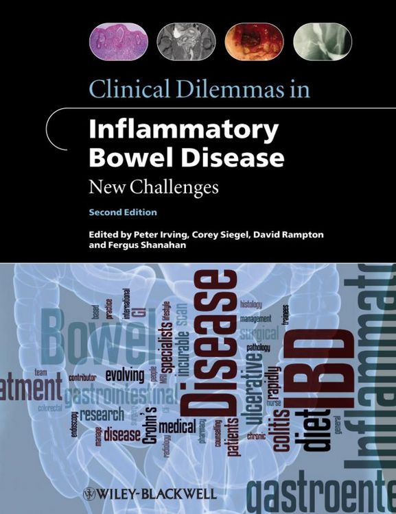 Produktbild: Clinical Dilemmas in Inflammatory Bowel Disease