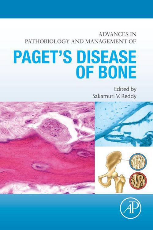 Produktbild: Advances in Pathobiology and Management of Paget's Disease of Bone