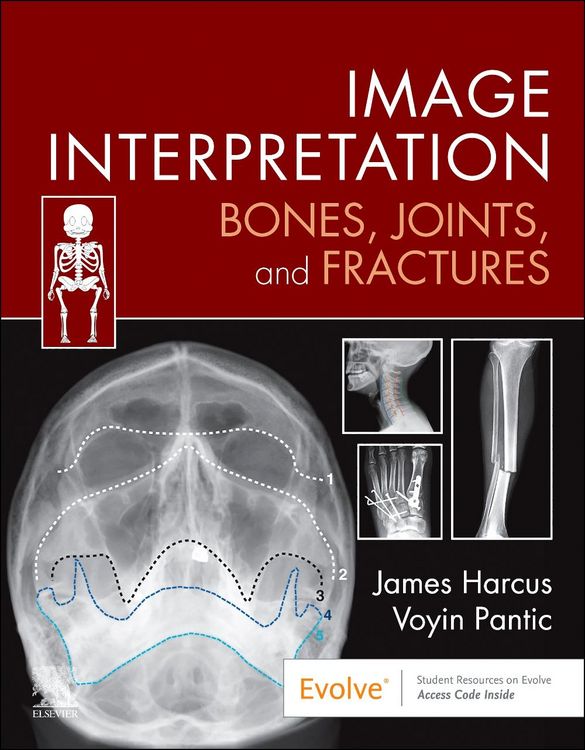 Produktbild: Image Interpretation: Bones, Joints, and Fractures