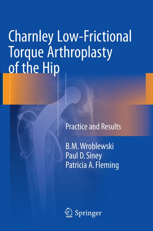 Produktbild: Charnley Low-Frictional Torque Arthroplasty of the Hip