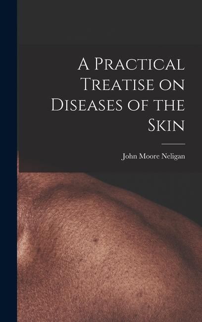 Produktbild: A Practical Treatise on Diseases of the Skin