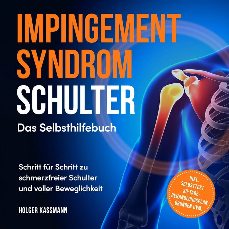 Produktbild: Impingement Syndrom Schulter - Das Selbsthilfebuch: Schritt f&uuml;r Schritt zu schmerzfreier Schulter und voller Beweglichkeit - inkl. Selbsttest, 30-Tage-Behandlungsplan, &Uuml;bungen uvm.