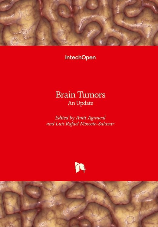 Produktbild: Brain Tumors