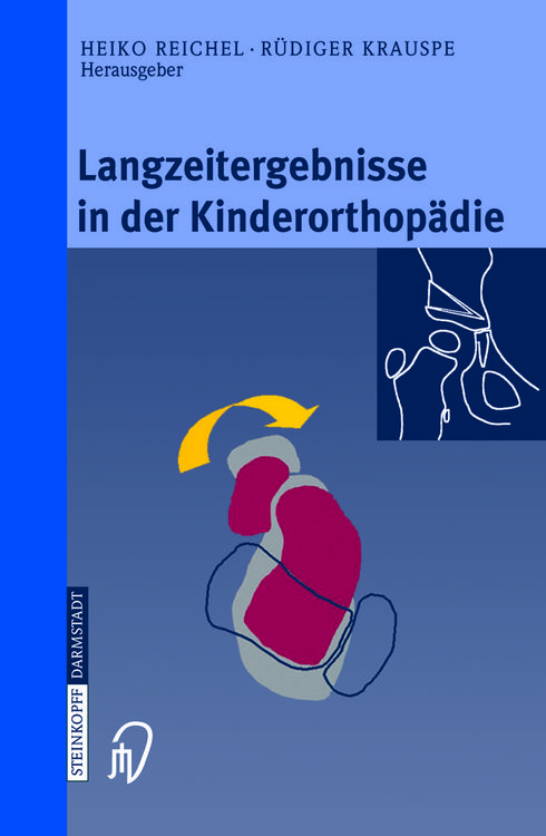 Produktbild: Langzeitergebnisse in der Kinderorthop&auml;die