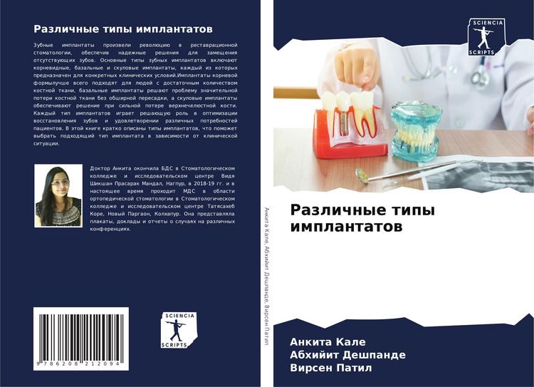 Produktbild: Razlichnye tipy implantatow