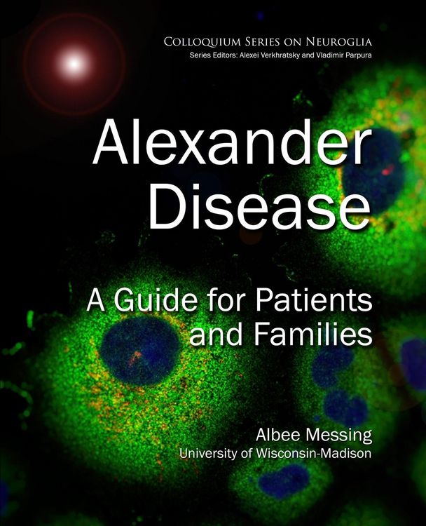Produktbild: Alexander Disease
